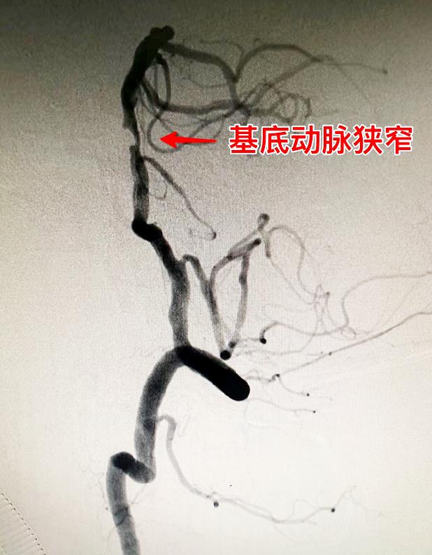 身体发出各种求救信号急需要休息,身体发出的求救信号知道了能救命