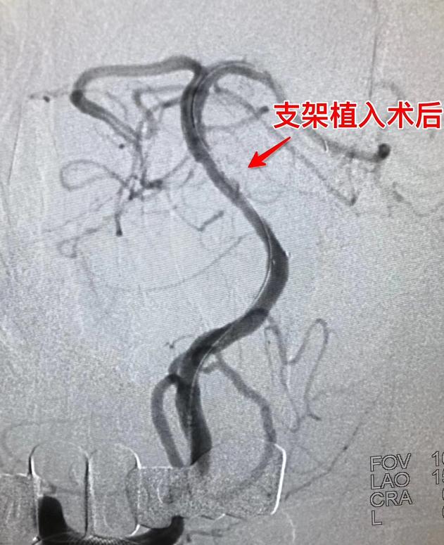 身体发出各种求救信号急需要休息,身体发出的求救信号知道了能救命