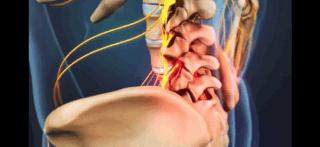 腰痛来龙去脉,腰疼真相