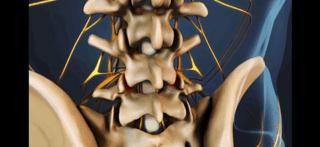 腰痛来龙去脉,腰疼真相