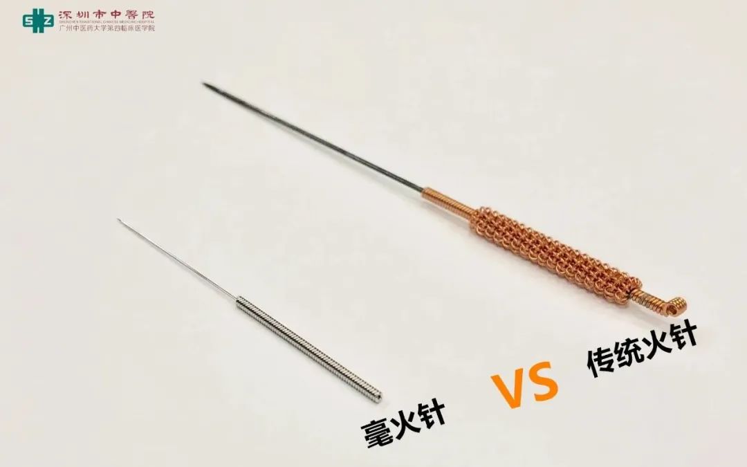 夏天穿两层棉裤还是冷，大爷无奈刺入烧红的钢针，效果竟出乎意料！【针灸宝鉴】