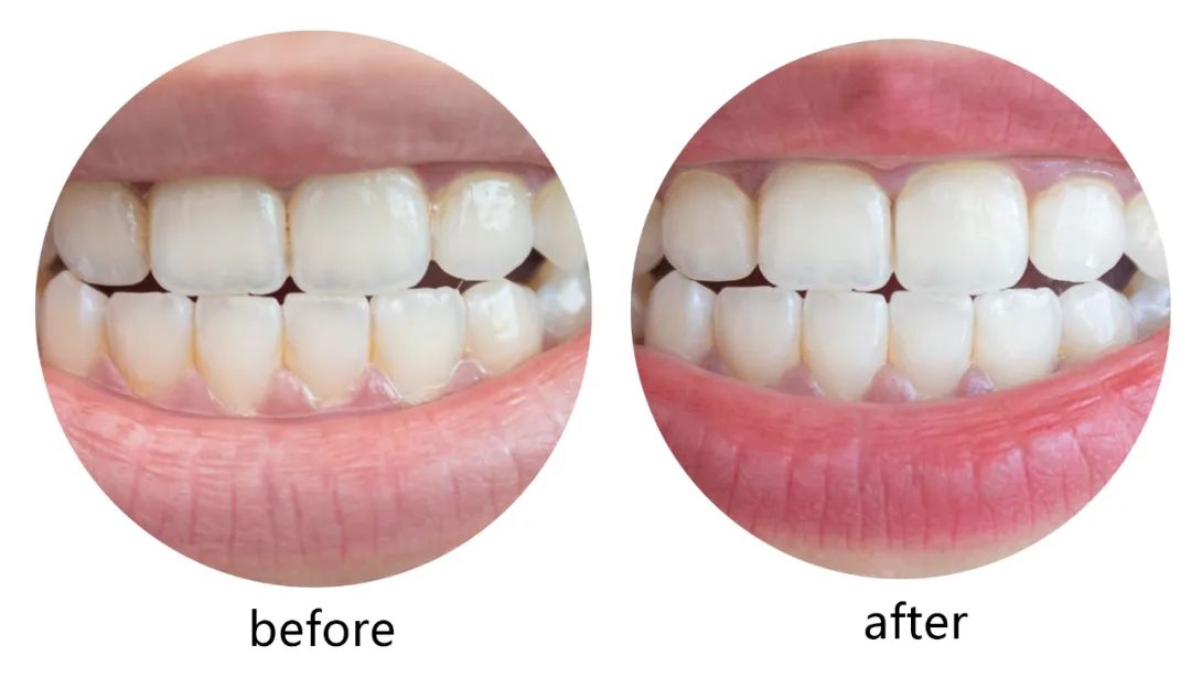 推广一款好产品,有什么必囤好物推荐