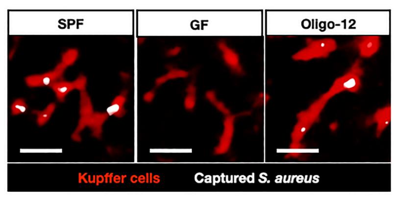 《细胞》子刊：肝脏给血液杀菌竟然靠肠菌帮忙！科学家发现肠菌释放的D-乳酸，可以帮助肝脏细胞清除血液中病原体丨科学大发现