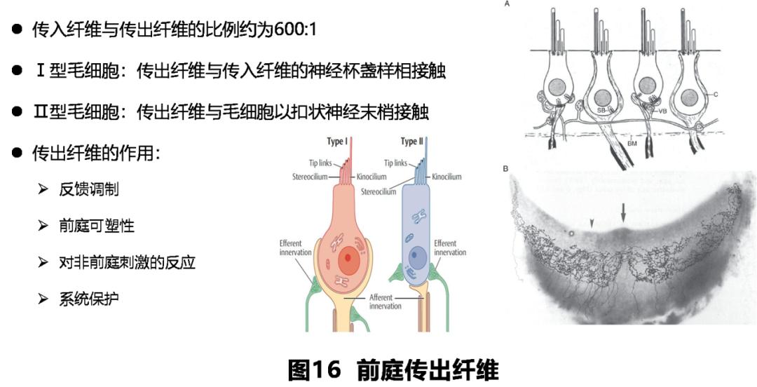 前庭性眩晕百科介绍,周围性眩晕和中枢性眩晕解剖基础