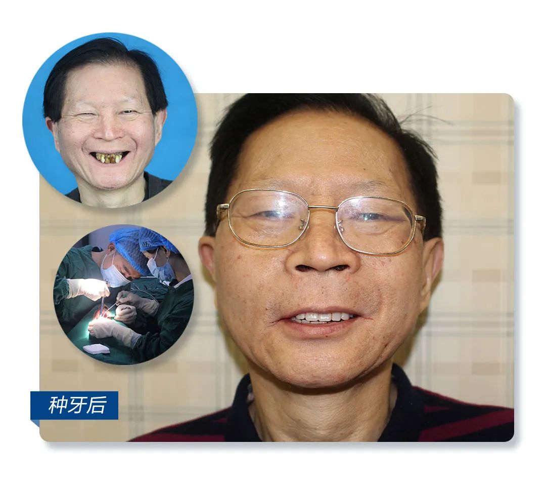 年轻牙齿掉光是什么报应,年轻人牙齿全部一次性掉光