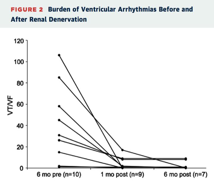 室速与室颤治疗上的区别,难治性室颤和室速