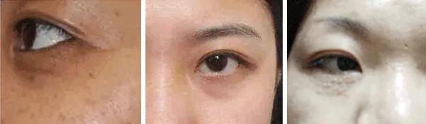 60岁没眼袋方法,教你一招去眼纹