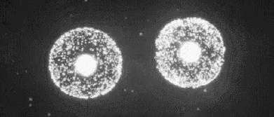 60岁没眼袋方法,教你一招去眼纹