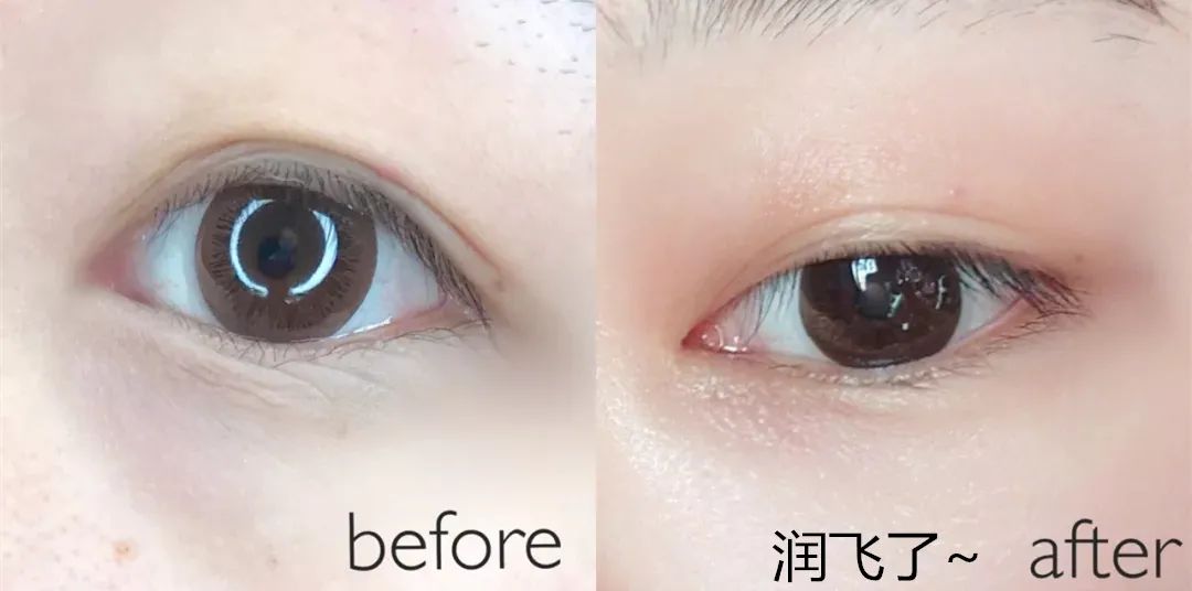 60岁没眼袋方法,教你一招去眼纹