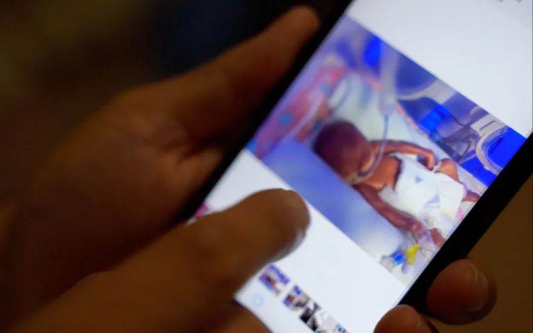 商丘早产儿死而复生后续,商丘早产儿死而复生疑点重重