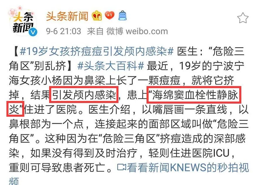 挤青春痘导致颅内感染症状,挤痘痘引发感染休克