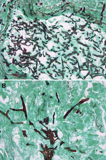 52岁男性肺部有肿块,老年男性胸痛的原因有哪些