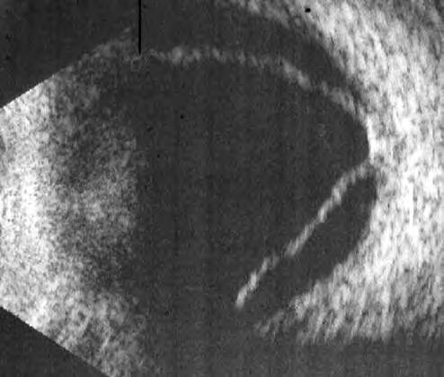 援非日记第三十八天,援非日记第一百天