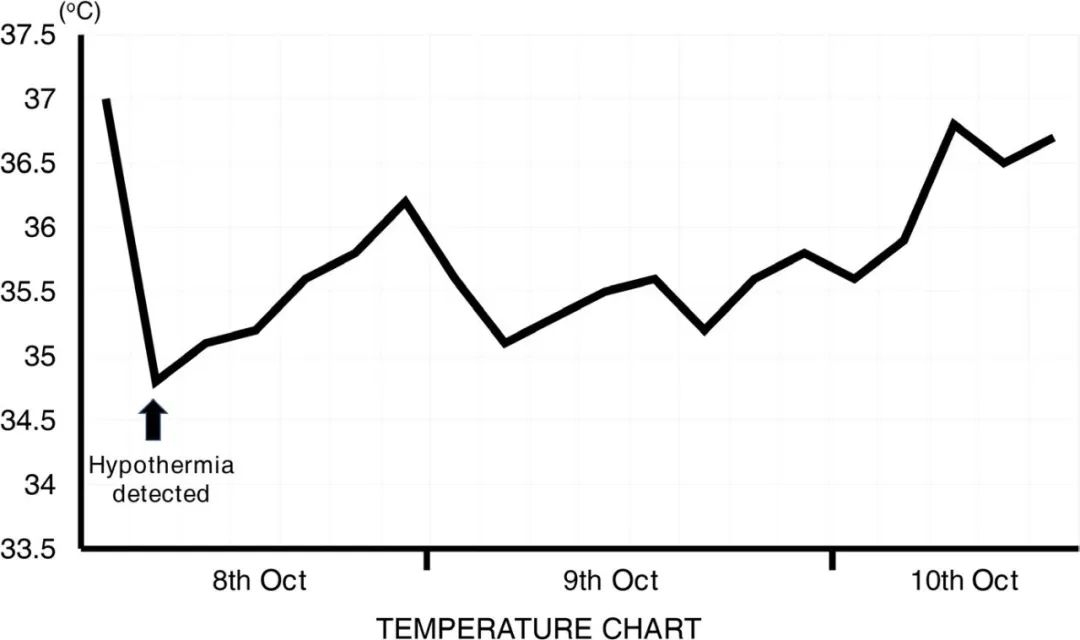 药物不良反应发烧怎么办,药物不良反应是怎么回事