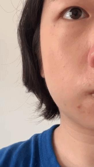 去斑点最有效方法医美去除斑痕,脸上暗沉有斑点可以做什么医美