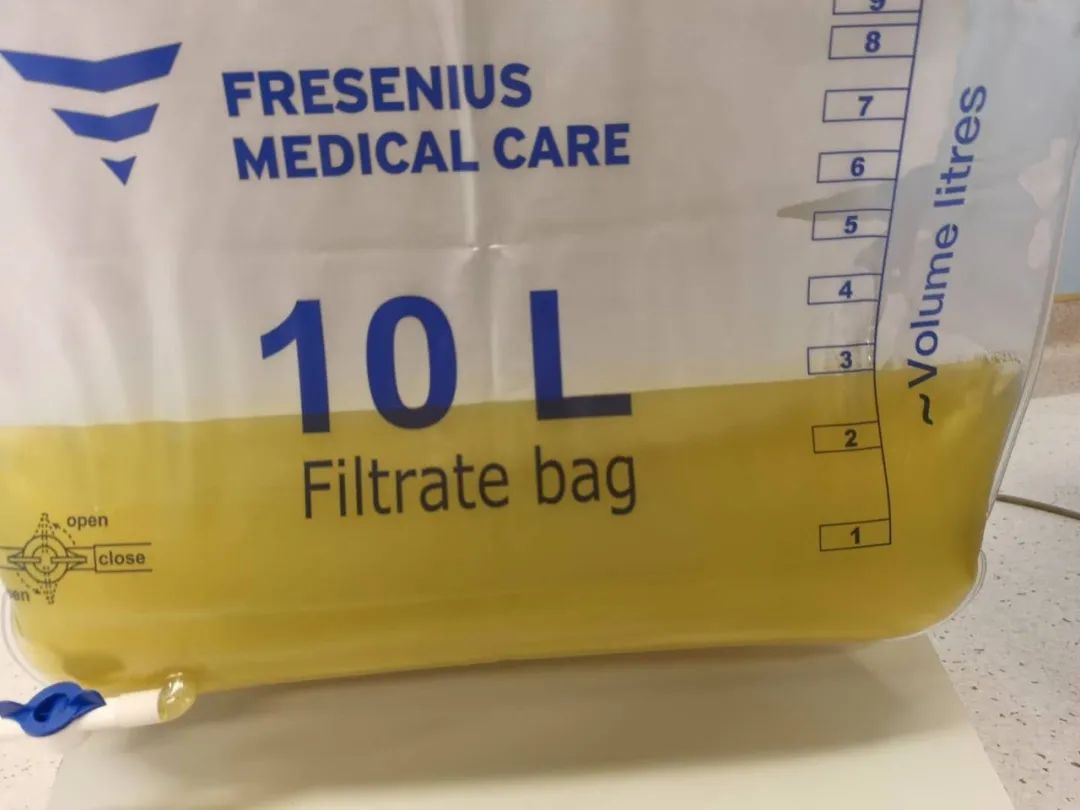 孕妇吃炸鸡2小时血糖6.5,孕早期不小心吃了隔夜的炸鸡