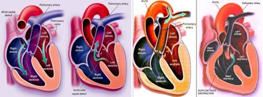世界心脏日视频,世界心脏日是什么意思