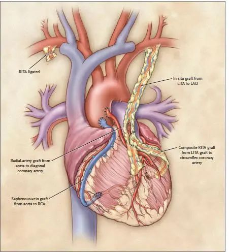 世界心脏日视频,世界心脏日是什么意思