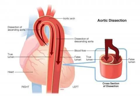 世界心脏日视频,世界心脏日是什么意思