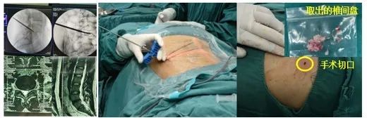 筋骨堂治疗视频,筋骨堂治疗效果怎么样