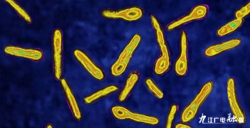 险！九江一高龄患者破伤风致重症危及生命ICU治疗一个半月仅因树枝刺伤被轻视