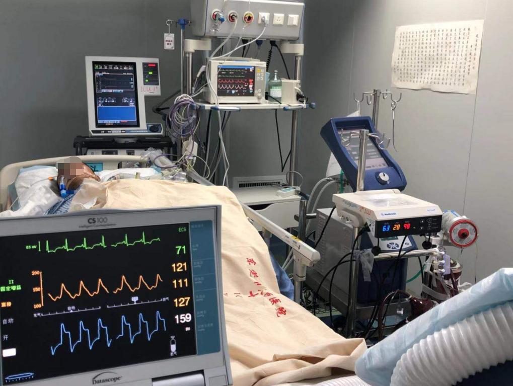东莞这些医院有ECMO！被神化的利器背后，考量医院综合实力！