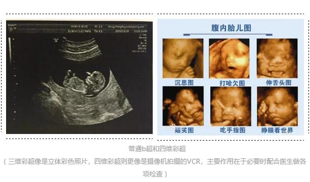 在肚子里拍照的宝宝,宝宝在妈妈肚子里的时候拍照