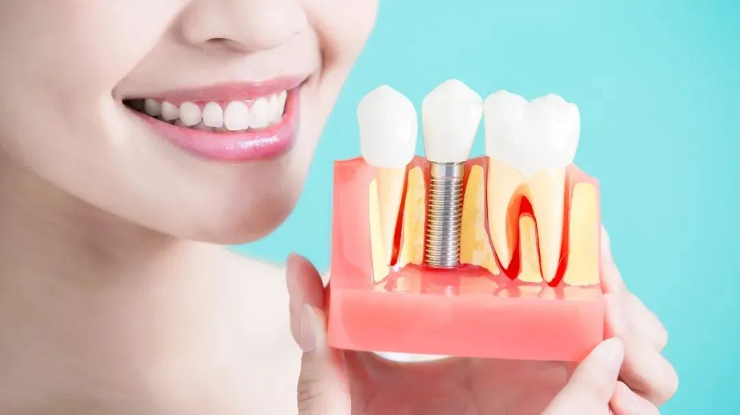 一般种植牙的使用寿命是多长时间,种植牙的使用寿命是多久