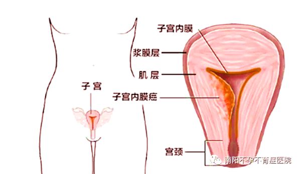从经血颜色看月经是否正常卢琰主任作出科学解析