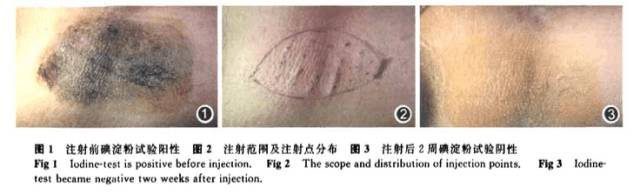 夏天女生该不该把腋毛剃掉,女生的腋毛可以剃吗