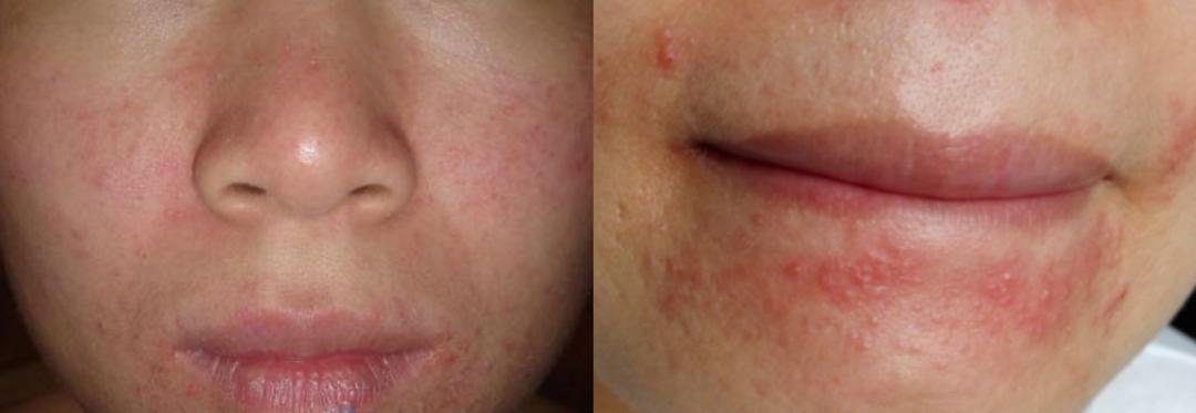 腿粗暗沉粗糙？为什么教程也救不了你的颜值bug？