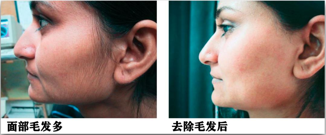 腿粗暗沉粗糙？为什么教程也救不了你的颜值bug？