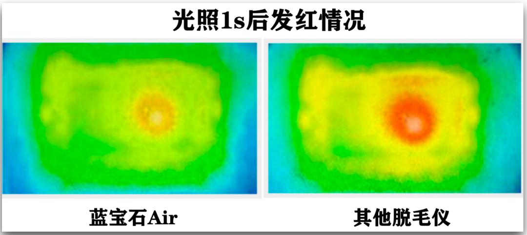 腿粗暗沉粗糙？为什么教程也救不了你的颜值bug？