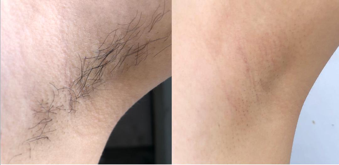 腿粗暗沉粗糙？为什么教程也救不了你的颜值bug？