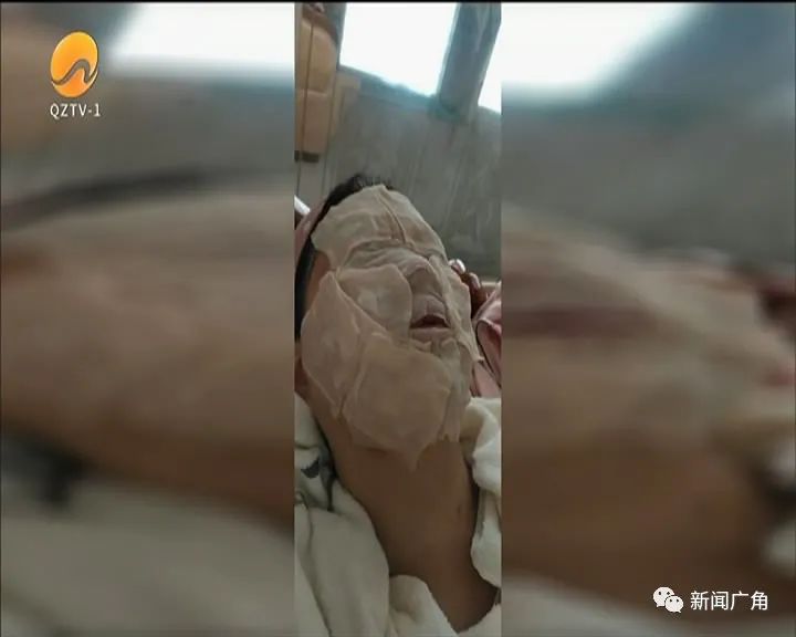 孕妇脸上过敏流脓,孕妇脸上红色丘疹脓包