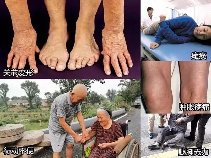 再也不用穿秋裤了！10秒让腿部恒温37度，袪湿又保暖，简直是老寒腿、关节炎的“救星”