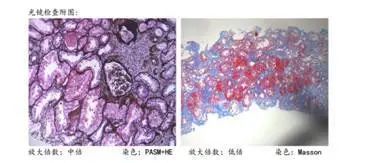 京鲁名医血液病联合会诊,北京援藏医疗队北医三院