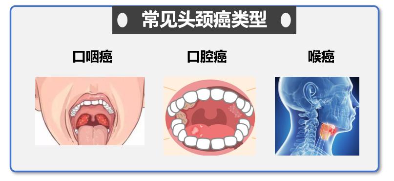 fda批准胃癌首款一线免疫疗法,中国最新癌症治疗进展