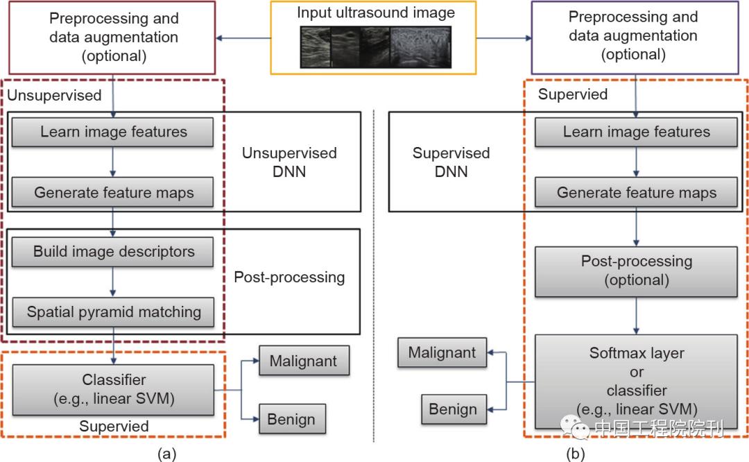 前沿医疗研究,超声前沿研究
