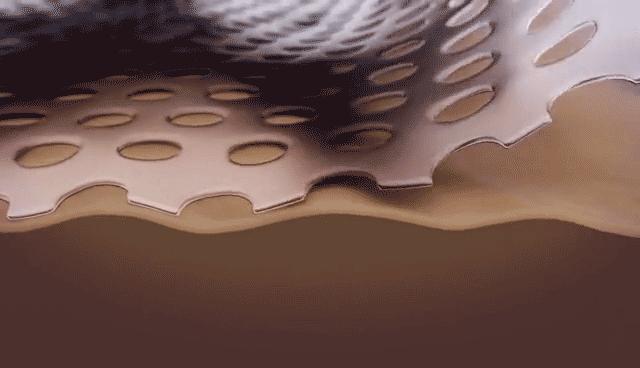 有效淡化疤痕的六个小妙招,贴上疤痕贴也长疤痕