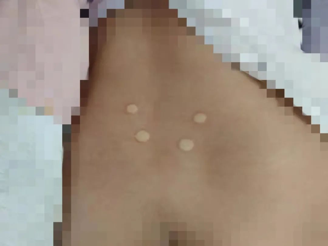 神奇的水世界,神奇的水袋实验原理