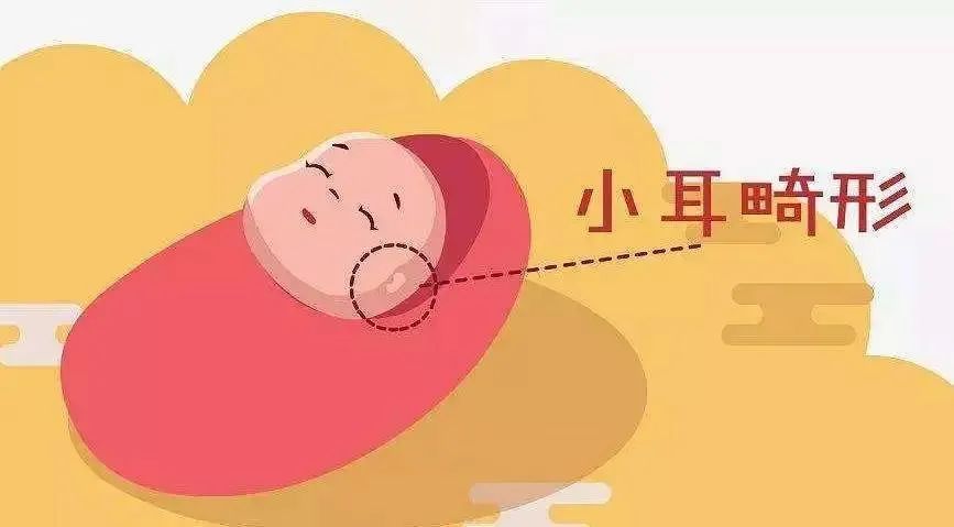 小耳畸形患者救助项目,小耳畸形援助最新消息