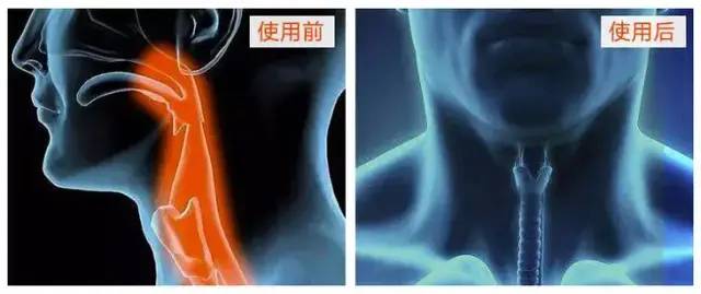 口臭吃了不会口臭的硬糖,口臭吃了糖就不臭了是什么原因