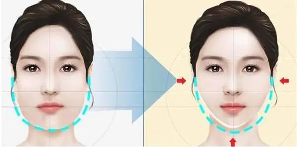 脸越来越圆胖是怎么回事,为什么腮和脸突然胖了好多