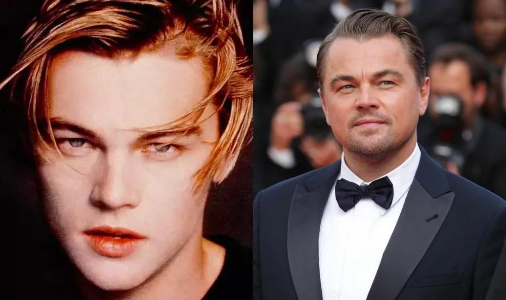 脸越来越圆胖是怎么回事,为什么腮和脸突然胖了好多