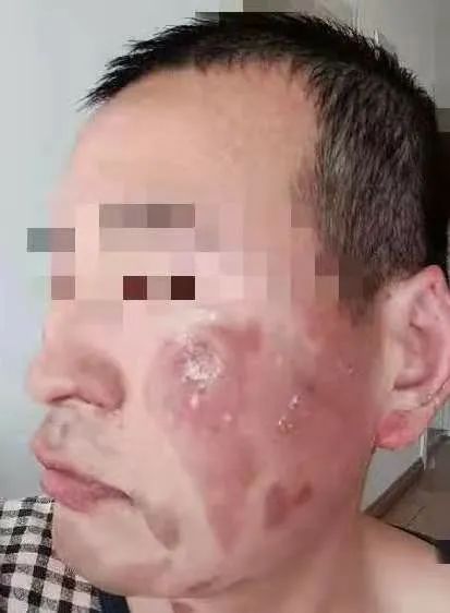 鐢峰瓙鍐昏劯,鐢峰瓙鏃╀笂鏅ㄨ窇閮藉喕鍐颁簡