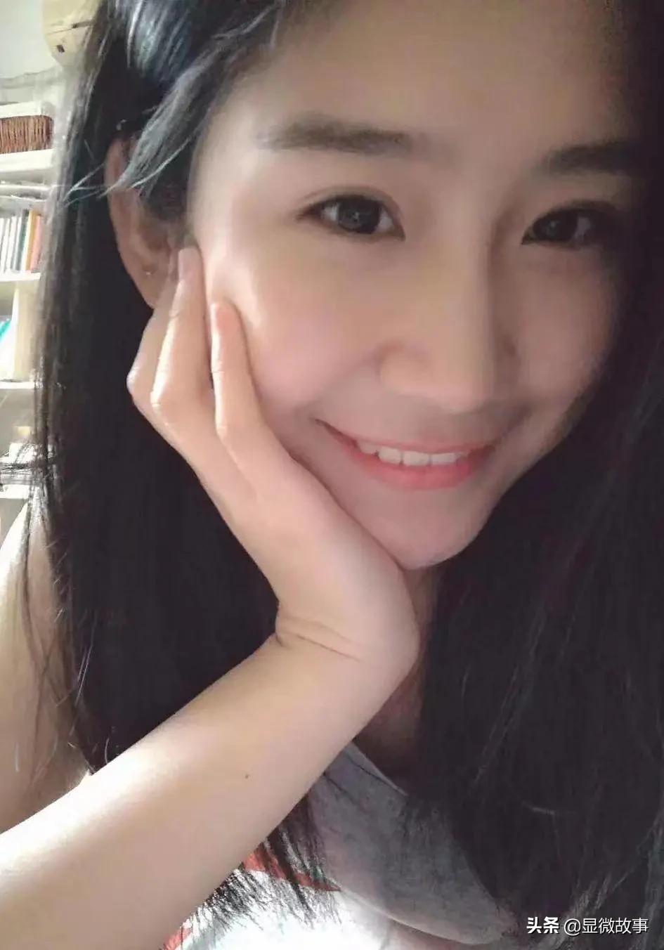 花三万块钱整容,4万元整容成歪鼻子