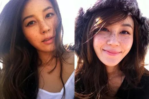 花了3万做激光，才彻底懂了：医生为什么劝你别去斑