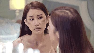 花了3万做激光，才彻底懂了：医生为什么劝你别去斑