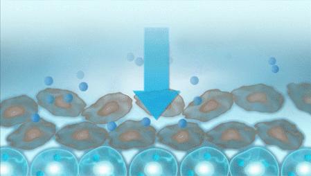 花了3万做激光，才彻底懂了：医生为什么劝你别去斑